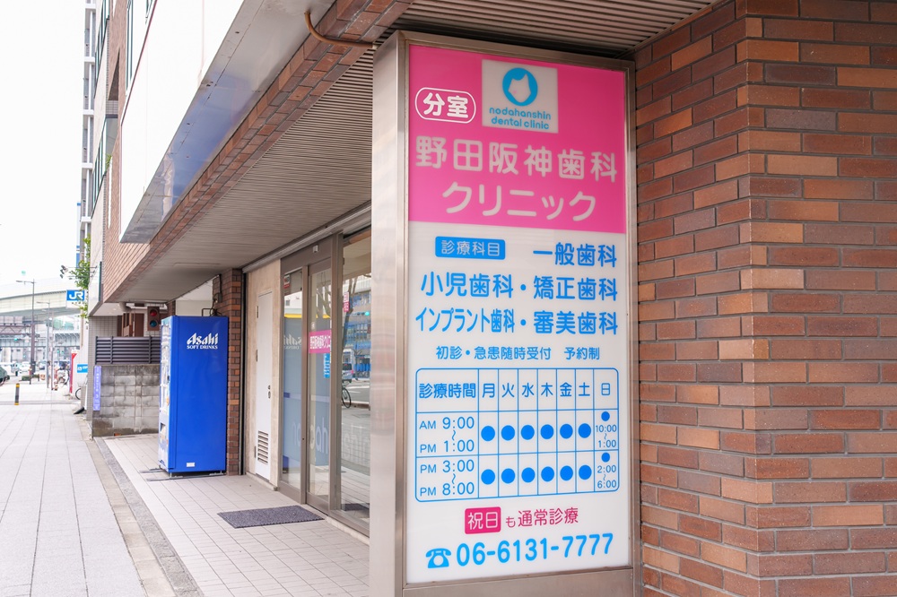 インプラントについてご相談ください